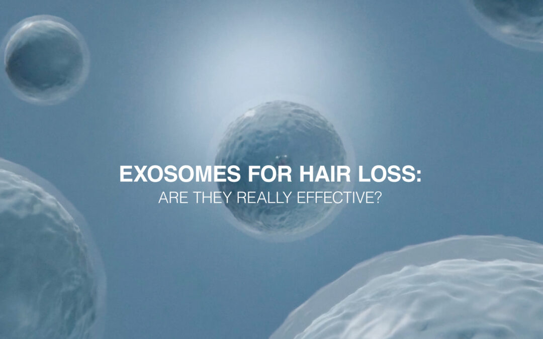 EXOSOMES FOR HAIR LOSS: ARE THEY REALLY EFFECTIVE?