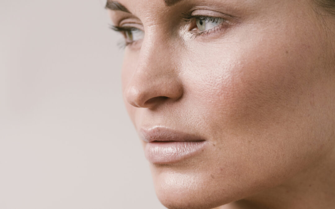 DRY SKIN IN WINTER: WHAT HAPPENS TO THE SKIN BARRIER AND HOW TO RESTORE IT